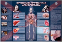 Электрифицированный стенд "Вредные привычки: алкоголизм" - «globural.ru» - Тобольск