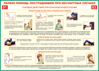 Таблица Порядок действий при опасном кровотечении 1000*1400 винил - «globural.ru» - Тобольск